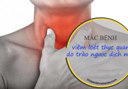 Trào ngược dịch mật dễ dẫn đến bệnh viêm loét thực quản